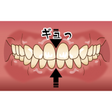 食いしばり